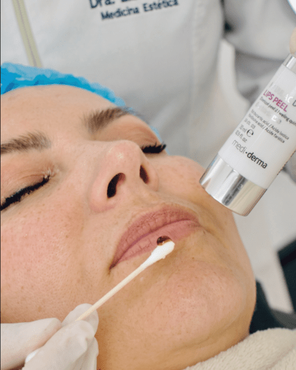 Peeling de labios