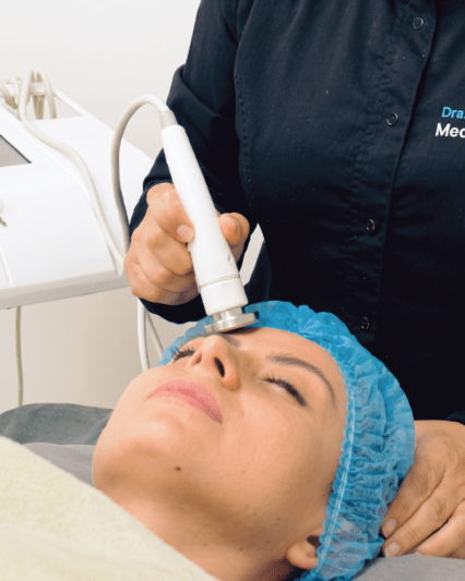 Radiofrecuencia facial - 3 sesiones