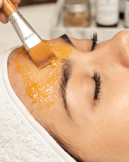 Peeling facial dermatológico - 1 sesión